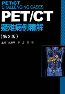 先婚后爱：总裁快走开